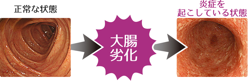 正常な状態 炎症を起こしている状態