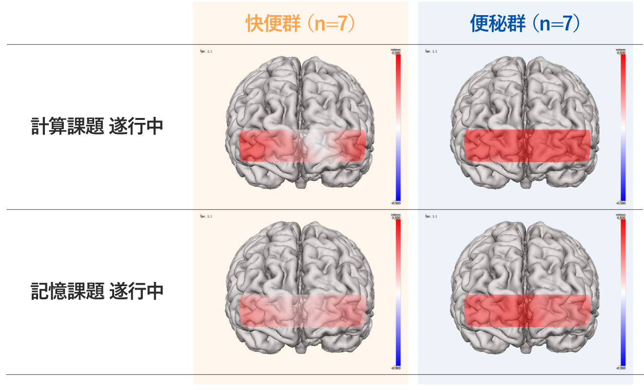 【図3】課題(計算課題、記憶課題)遂行中の光トポグラフィ画像